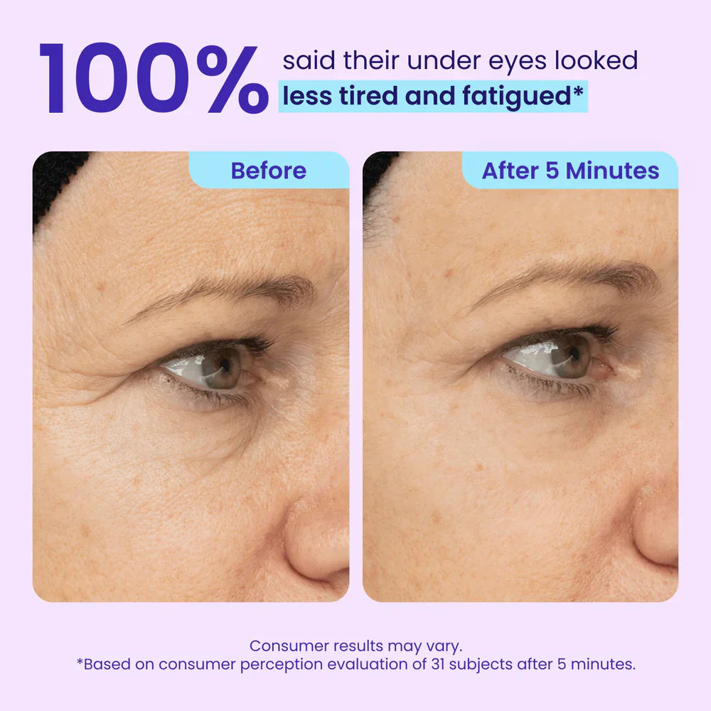 Ruzzur Instant Lift Eye Gel