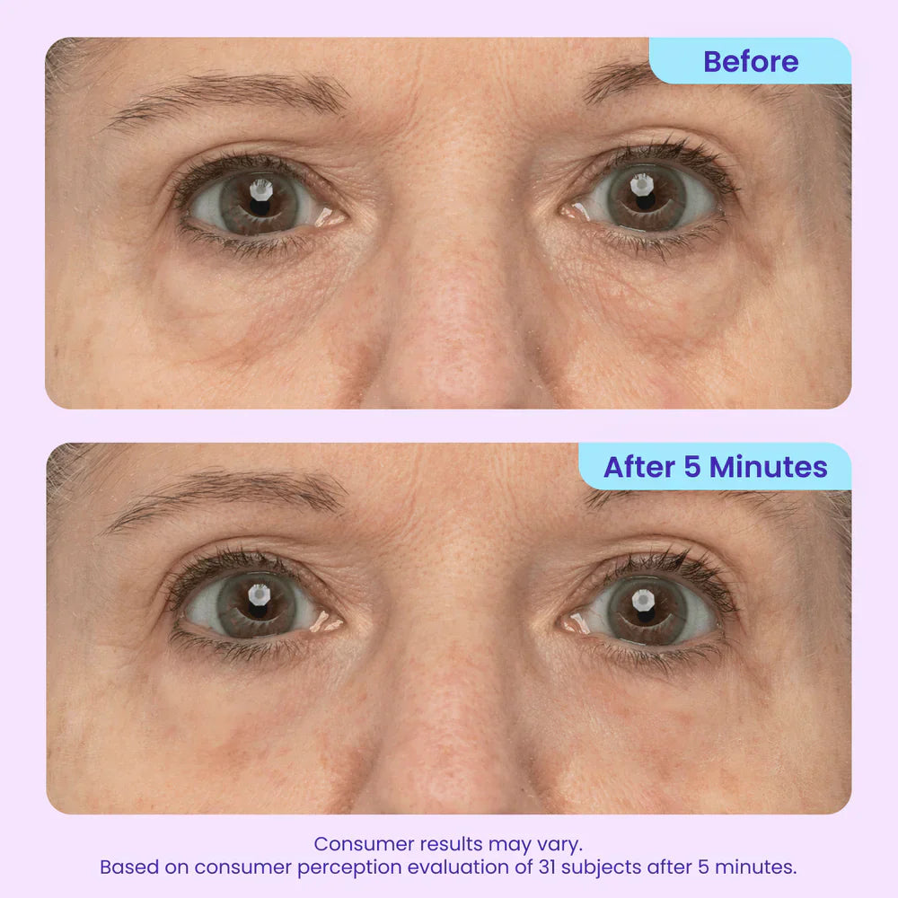 Ruzzur Instant Lift Eye Gel
